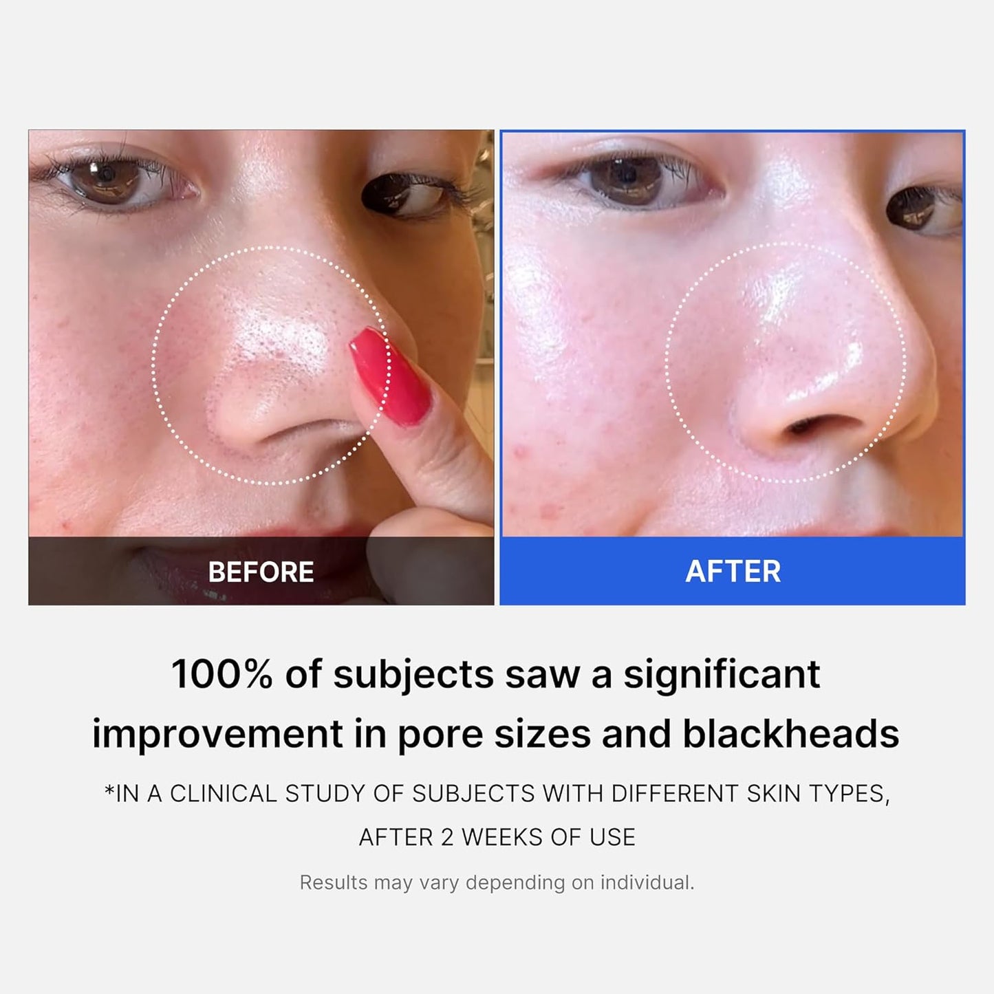 Medicube - Zero Pore Pads 2.0