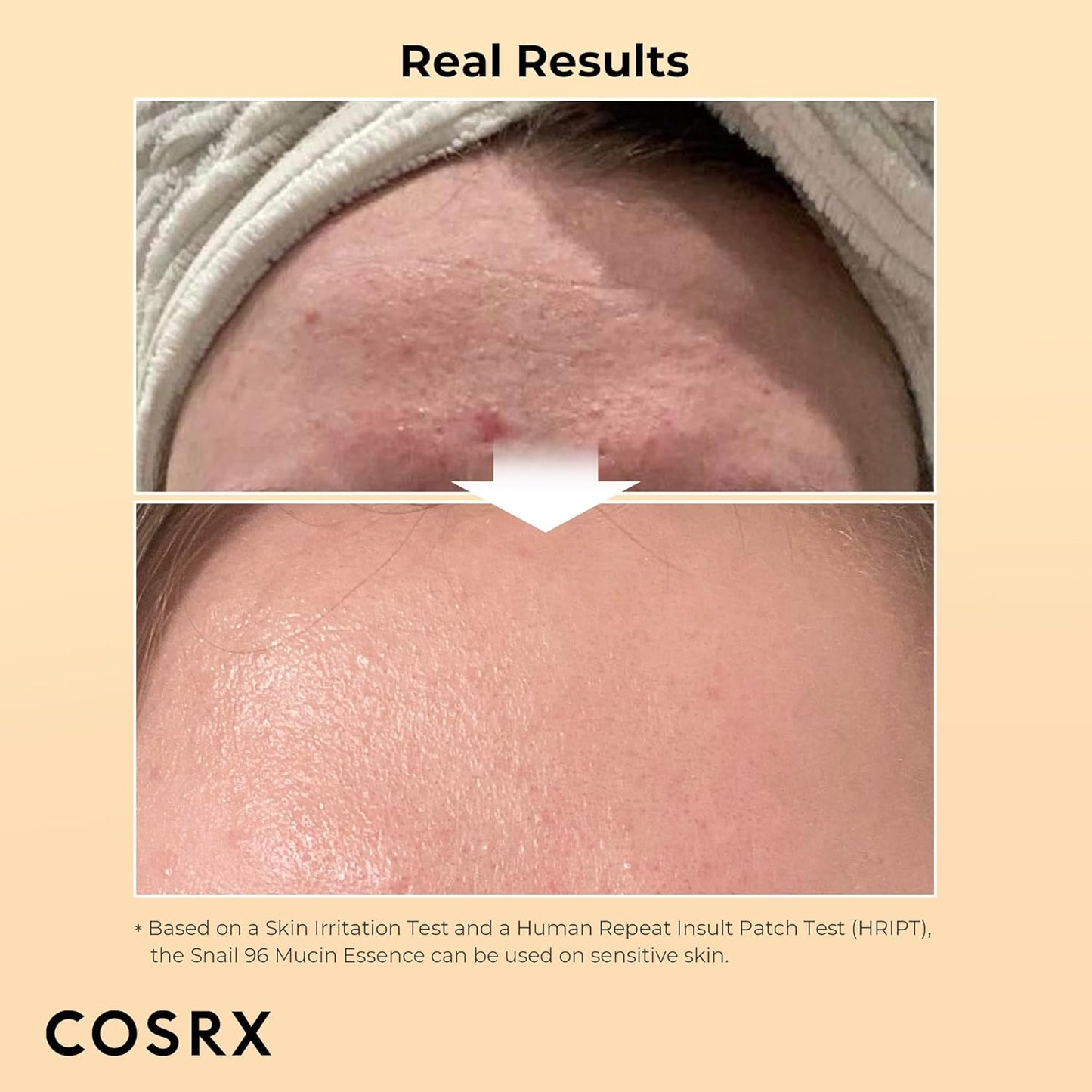 COSRX - Advanced Snail 96% Mucin Power Essence