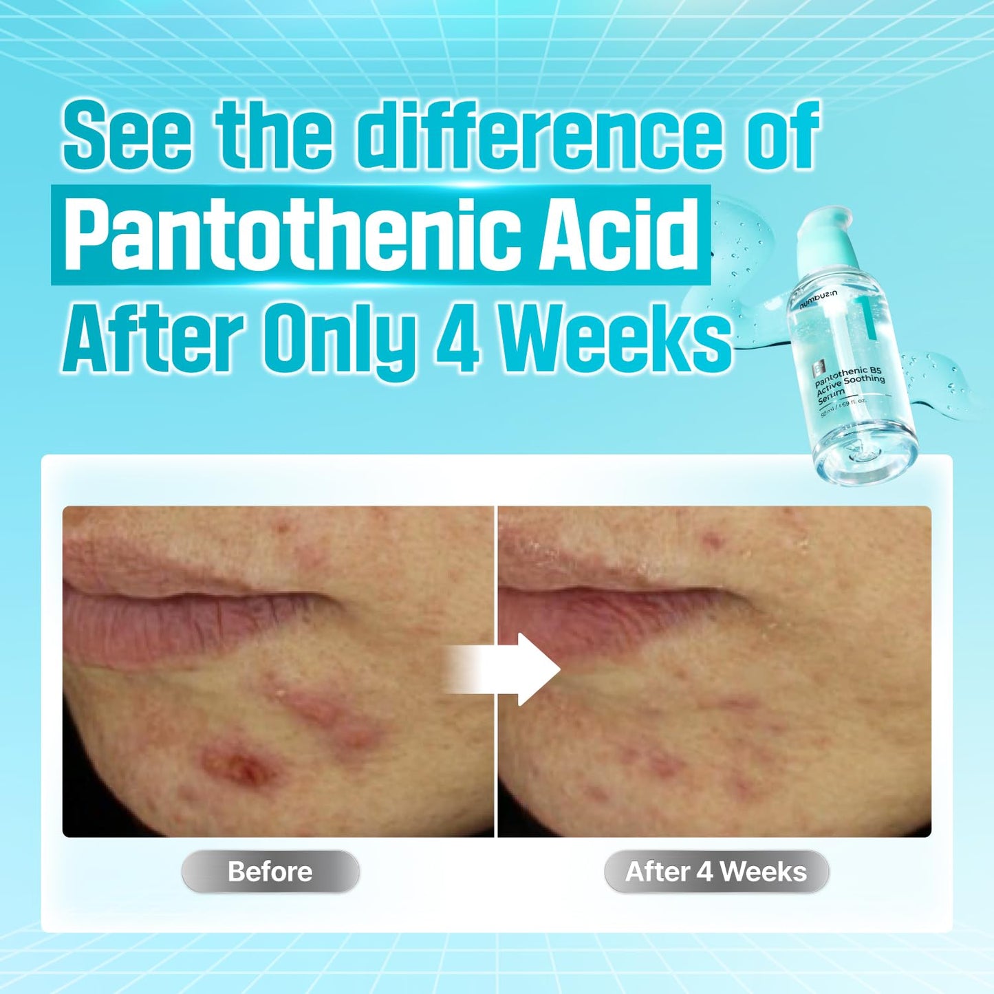 No.1 Pantothenic B5 Active Soothing Serum