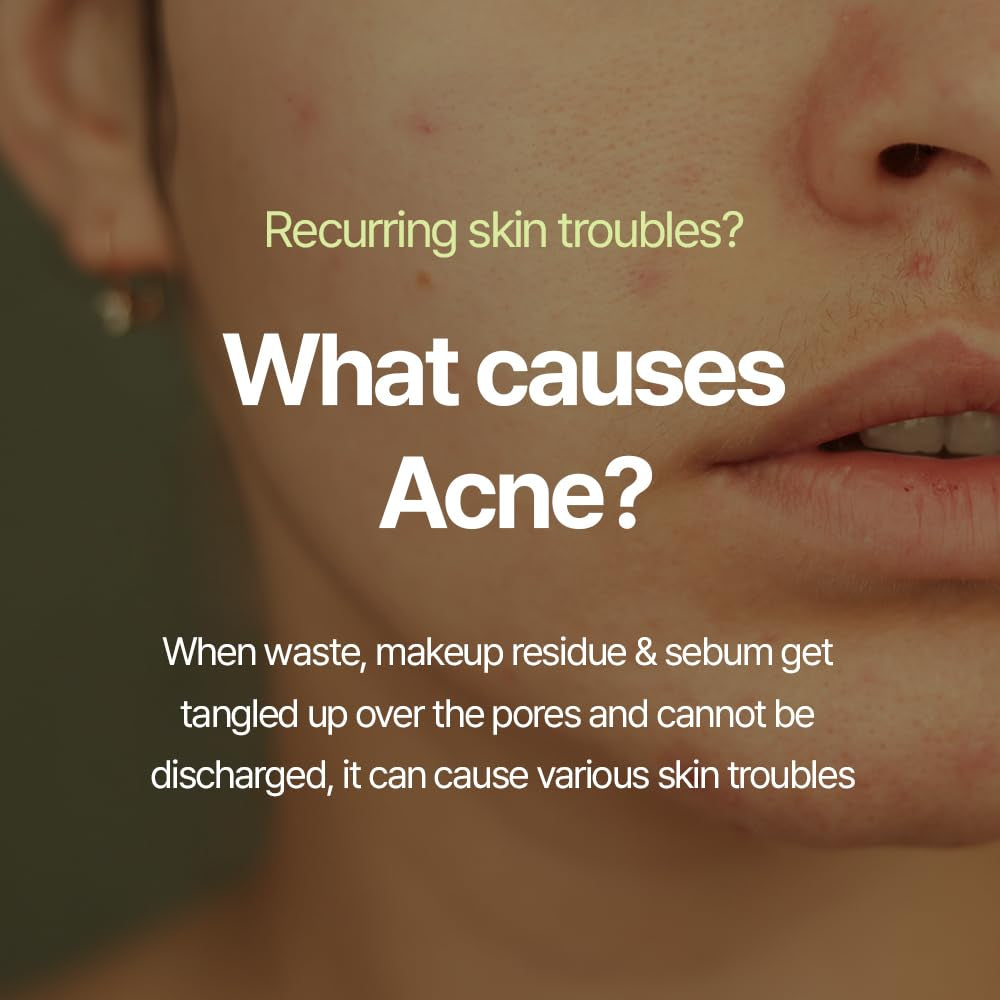 Calming Acne Cleansing Foam